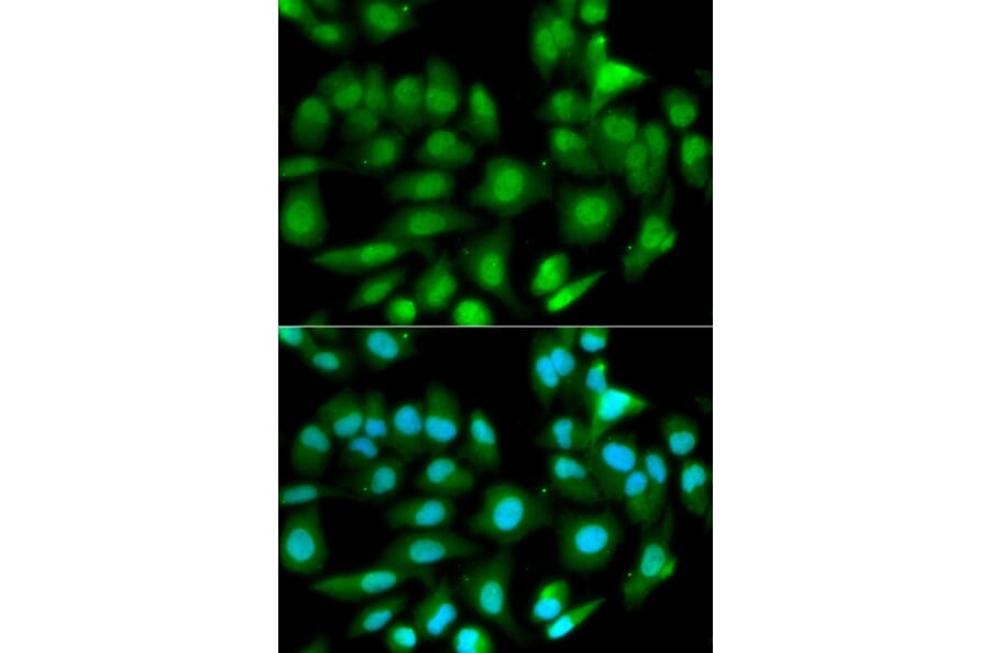 Immunofluorescence - GSTM2 Antibody from Signalway Antibody (32228) - Antibodies.com