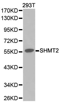 Western blot analysis of 293T cell lysate using SHMT2 antibody.
