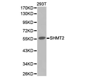 Western blot - SHMT2 Antibody from Signalway Antibody (32233) - Antibodies.com