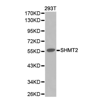 Western blot - SHMT2 Antibody from Signalway Antibody (32233) - Antibodies.com