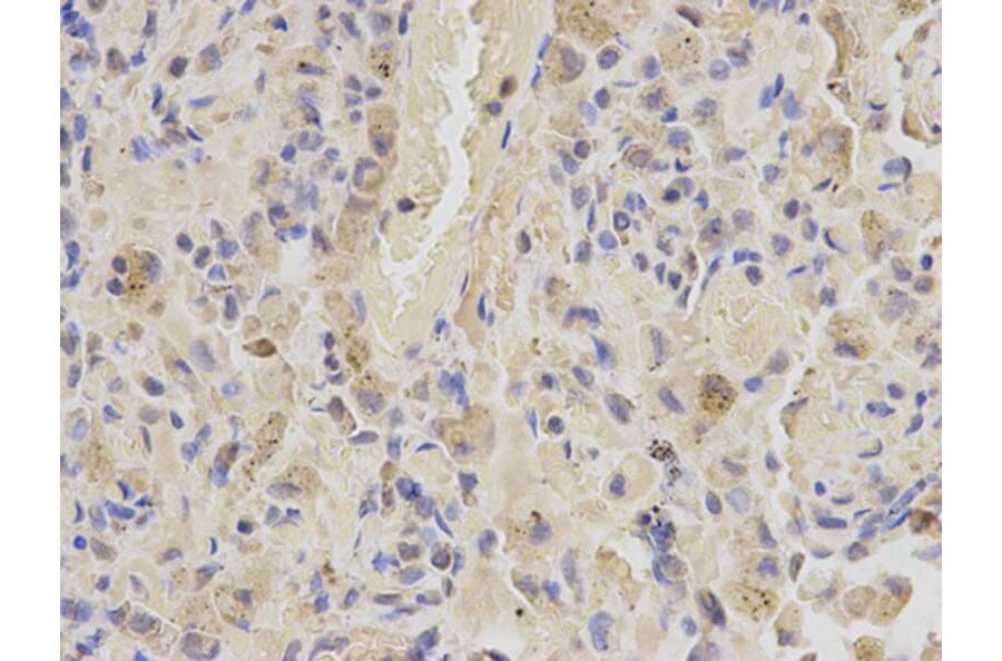 Immunohistochemistry - SHMT2 Antibody from Signalway Antibody (32233) - Antibodies.com