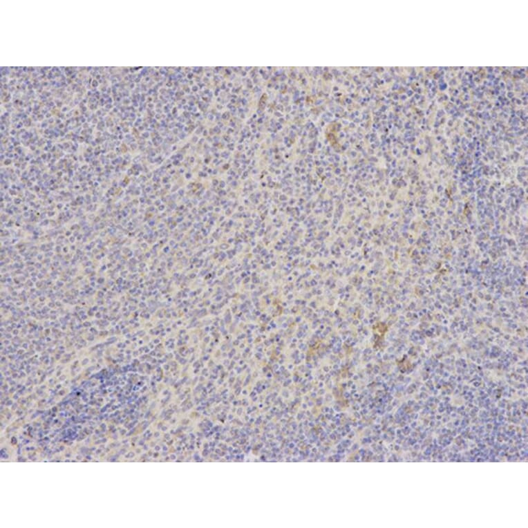 Immunohistochemistry - SHMT2 Antibody from Signalway Antibody (32233) - Antibodies.com