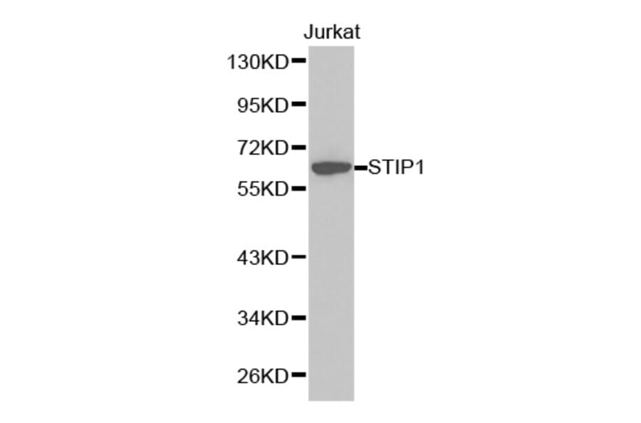 Western blot - STIP1 Antibody from Signalway Antibody (32236) - Antibodies.com