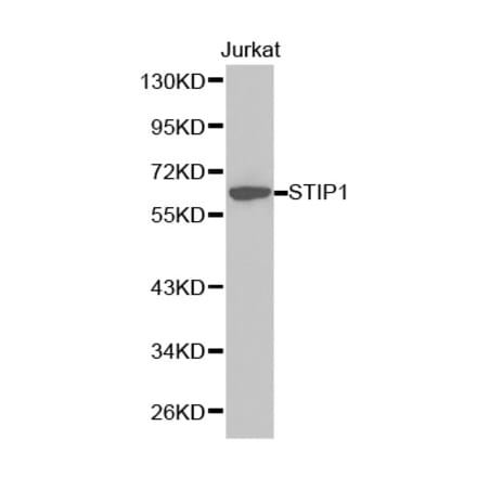 Western blot - STIP1 Antibody from Signalway Antibody (32236) - Antibodies.com