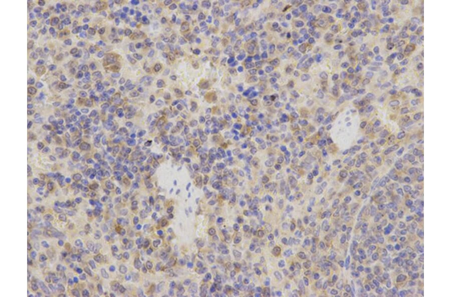 Immunohistochemistry - STIP1 Antibody from Signalway Antibody (32236) - Antibodies.com