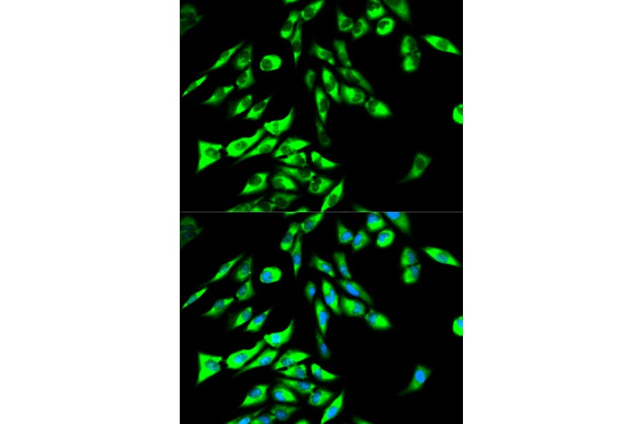 Immunofluorescence - STIP1 Antibody from Signalway Antibody (32236) - Antibodies.com
