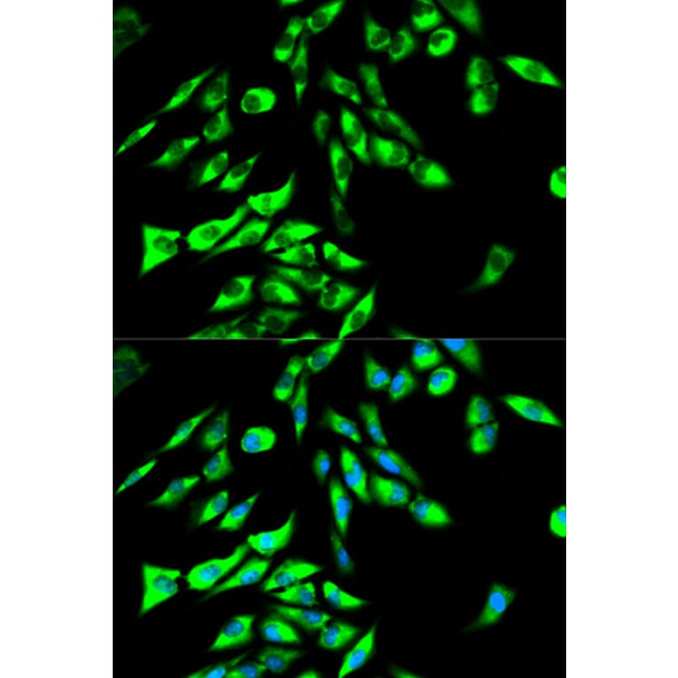 Immunofluorescence - STIP1 Antibody from Signalway Antibody (32236) - Antibodies.com