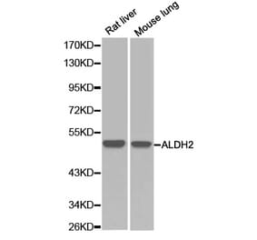 Western blot - ALDH2 Antibody from Signalway Antibody (32241) - Antibodies.com