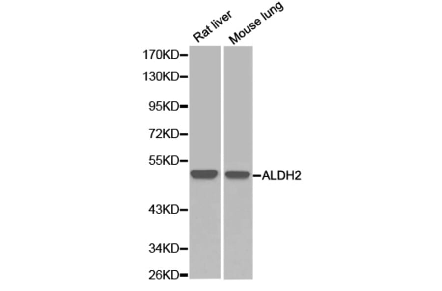 Western blot - ALDH2 Antibody from Signalway Antibody (32241) - Antibodies.com