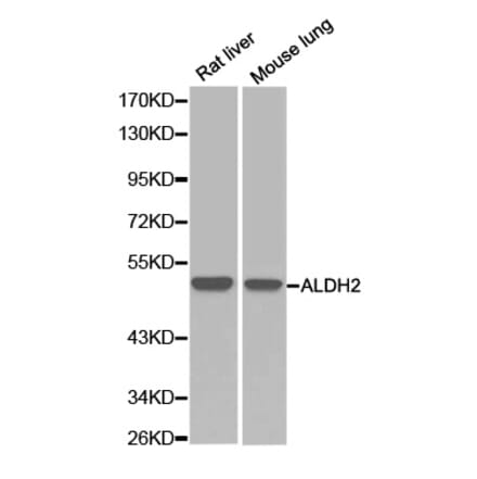 Western blot - ALDH2 Antibody from Signalway Antibody (32241) - Antibodies.com