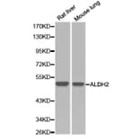 Western blot - ALDH2 Antibody from Signalway Antibody (32241) - Antibodies.com
