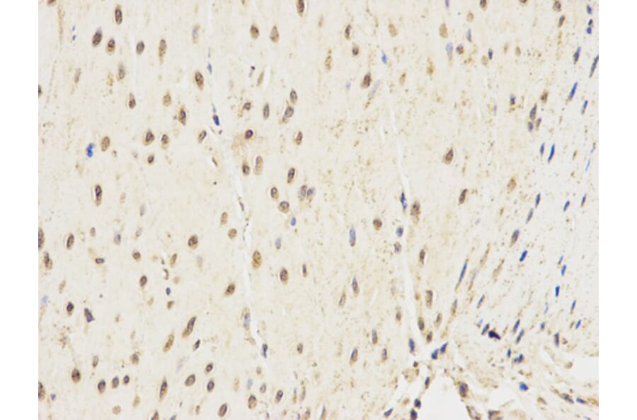 Immunohistochemistry - ALDH2 Antibody from Signalway Antibody (32241) - Antibodies.com
