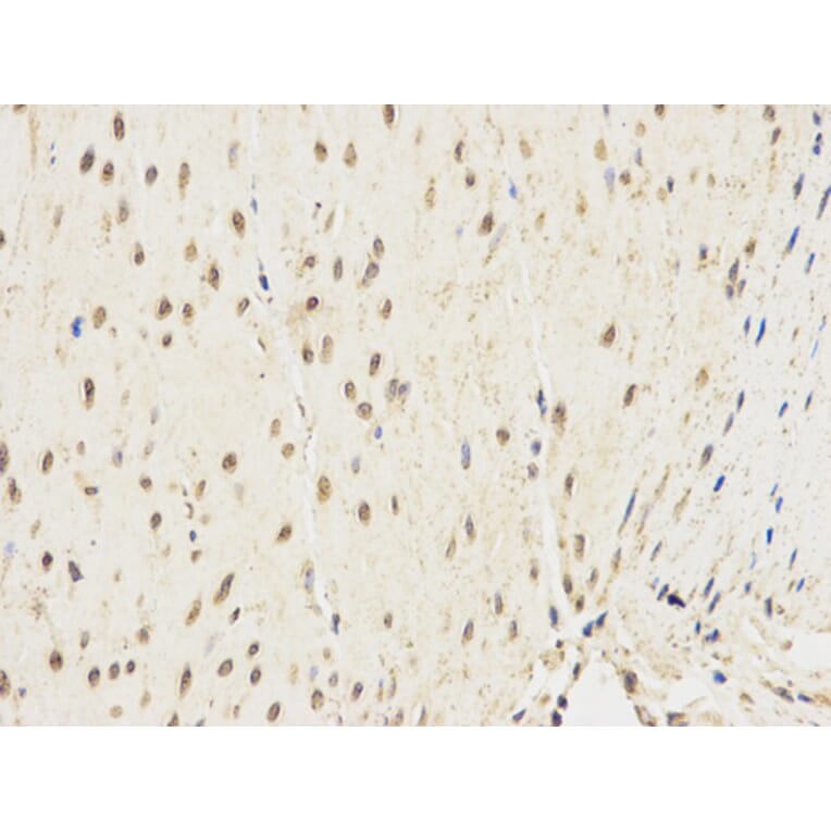 Immunohistochemistry - ALDH2 Antibody from Signalway Antibody (32241) - Antibodies.com