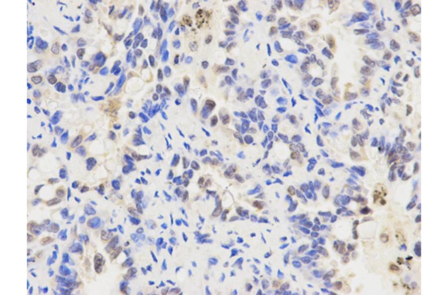 Immunohistochemistry - ALDH2 Antibody from Signalway Antibody (32241) - Antibodies.com