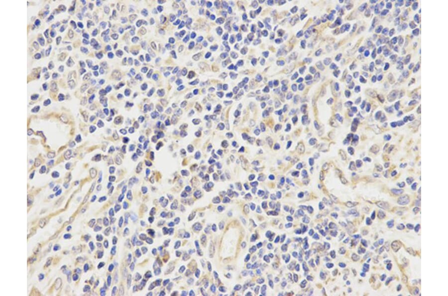 Immunohistochemistry - ALDH2 Antibody from Signalway Antibody (32241) - Antibodies.com