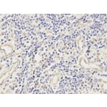 Immunohistochemistry - ALDH2 Antibody from Signalway Antibody (32241) - Antibodies.com