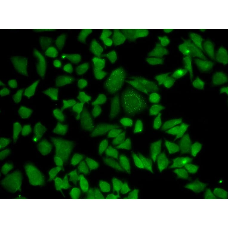 Immunofluorescence - ALDH2 Antibody from Signalway Antibody (32241) - Antibodies.com
