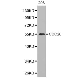 Western blot - CDC20 Antibody from Signalway Antibody (32246) - Antibodies.com