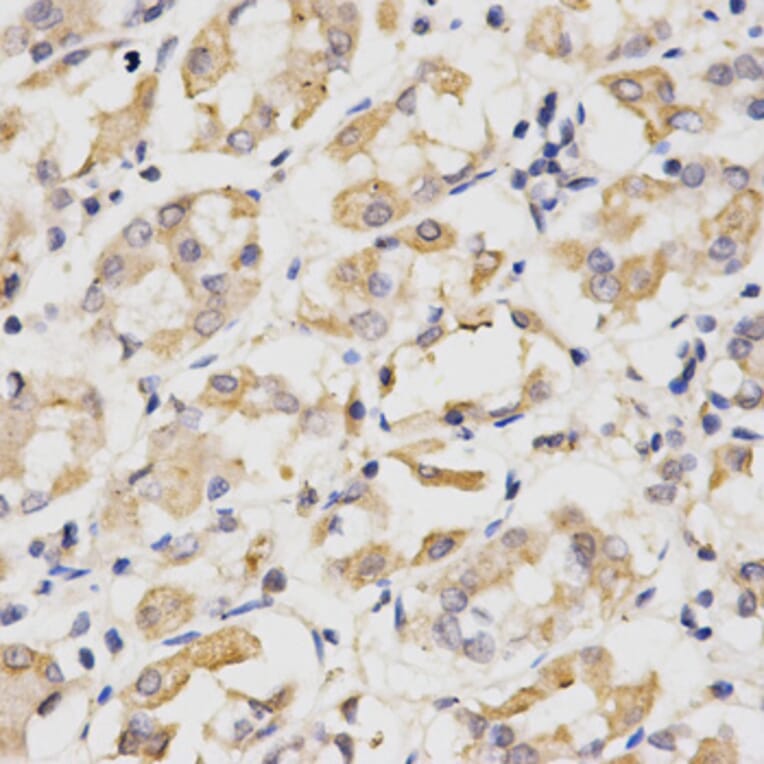 Immunohistochemistry - CDC20 Antibody from Signalway Antibody (32246) - Antibodies.com