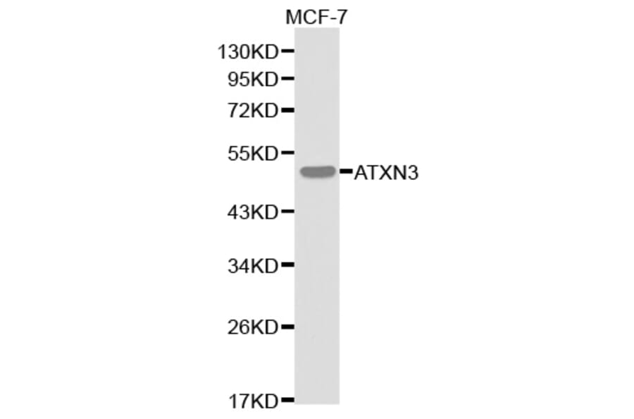 Western blot - ATXN3 Antibody from Signalway Antibody (32253) - Antibodies.com
