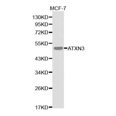 Western blot - ATXN3 Antibody from Signalway Antibody (32253) - Antibodies.com