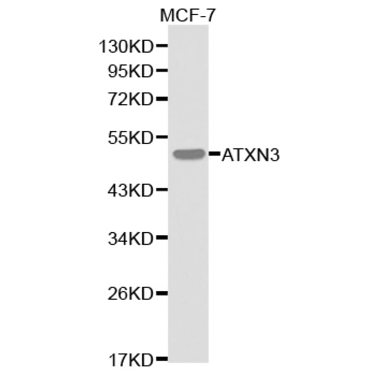 Western blot - ATXN3 Antibody from Signalway Antibody (32253) - Antibodies.com