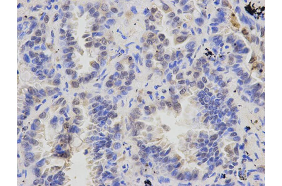 Immunohistochemistry - ATXN3 Antibody from Signalway Antibody (32253) - Antibodies.com