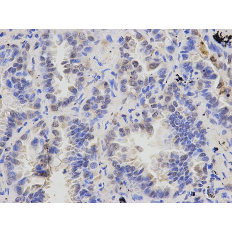 Immunohistochemistry - ATXN3 Antibody from Signalway Antibody (32253) - Antibodies.com