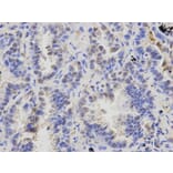 Immunohistochemistry - ATXN3 Antibody from Signalway Antibody (32253) - Antibodies.com