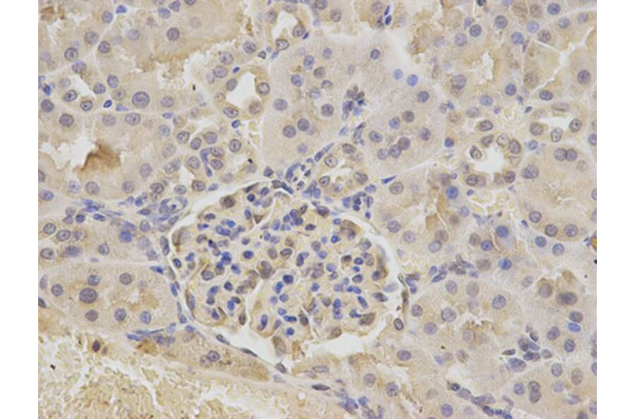 Immunohistochemistry - ATXN3 Antibody from Signalway Antibody (32253) - Antibodies.com