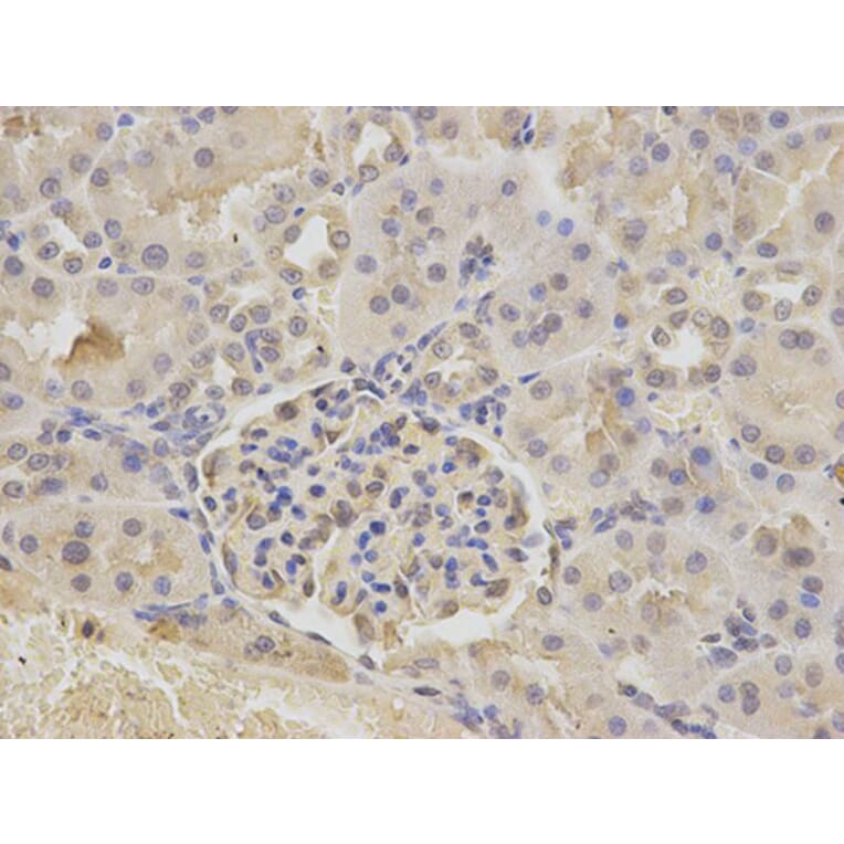 Immunohistochemistry - ATXN3 Antibody from Signalway Antibody (32253) - Antibodies.com