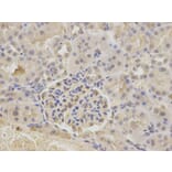 Immunohistochemistry - ATXN3 Antibody from Signalway Antibody (32253) - Antibodies.com