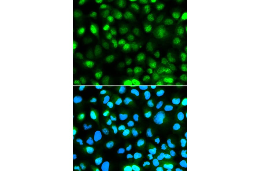 Immunofluorescence - ATXN3 Antibody from Signalway Antibody (32253) - Antibodies.com