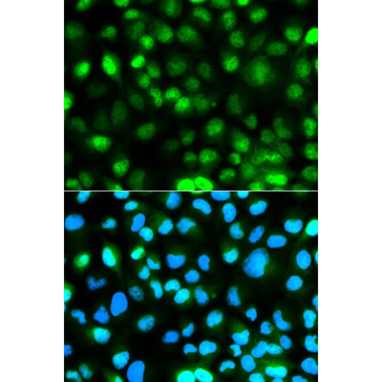 Immunofluorescence - ATXN3 Antibody from Signalway Antibody (32253) - Antibodies.com