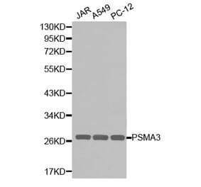 Western blot - PSMA3 Antibody from Signalway Antibody (32255) - Antibodies.com
