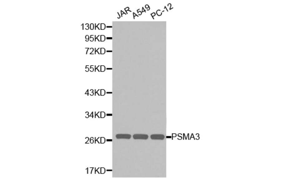 Western blot - PSMA3 Antibody from Signalway Antibody (32255) - Antibodies.com