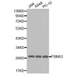 Western blot - PSMA3 Antibody from Signalway Antibody (32255) - Antibodies.com