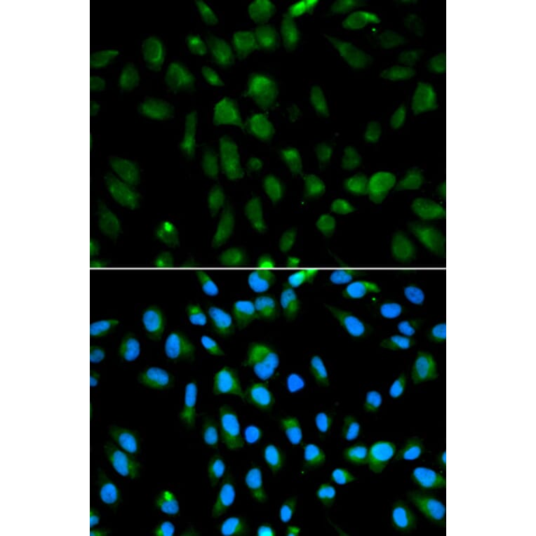 Immunofluorescence - PSMA3 Antibody from Signalway Antibody (32255) - Antibodies.com