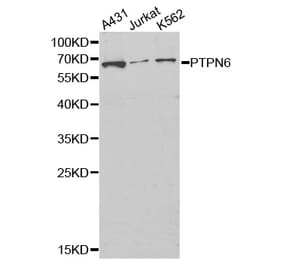 Western blot - PTPN6 Antibody from Signalway Antibody (32280) - Antibodies.com