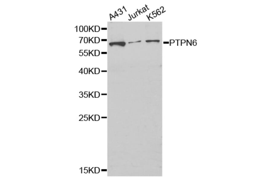 Western blot - PTPN6 Antibody from Signalway Antibody (32280) - Antibodies.com