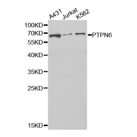 Western blot - PTPN6 Antibody from Signalway Antibody (32280) - Antibodies.com