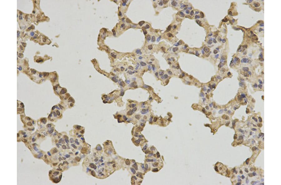 Immunohistochemistry - PTPN6 Antibody from Signalway Antibody (32280) - Antibodies.com