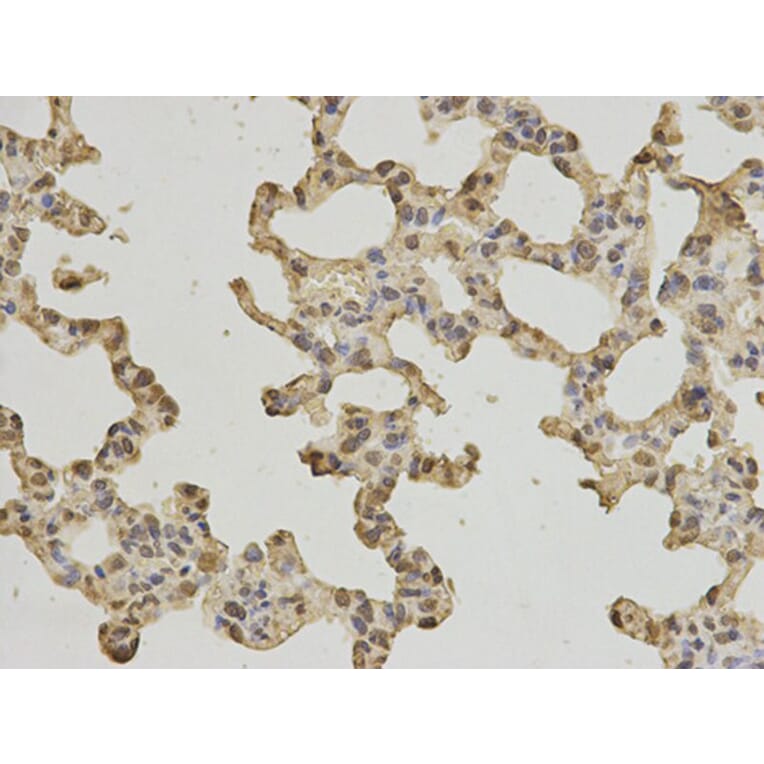 Immunohistochemistry - PTPN6 Antibody from Signalway Antibody (32280) - Antibodies.com