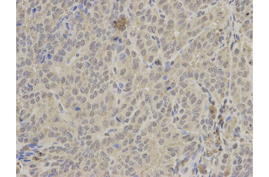 Immunohistochemistry - PTPN6 Antibody from Signalway Antibody (32280) - Antibodies.com