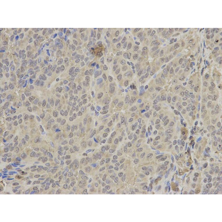 Immunohistochemistry - PTPN6 Antibody from Signalway Antibody (32280) - Antibodies.com