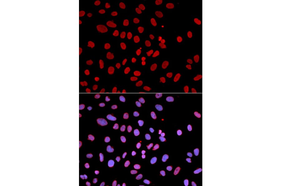 Immunofluorescence - PTPN6 Antibody from Signalway Antibody (32280) - Antibodies.com