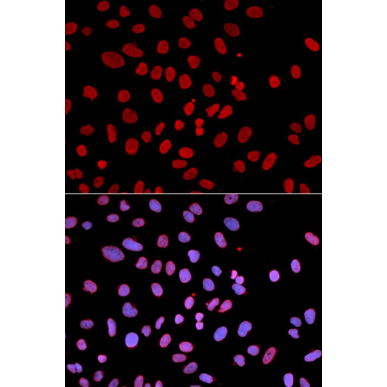 Immunofluorescence - PTPN6 Antibody from Signalway Antibody (32280) - Antibodies.com