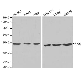 Western blot - PICK1 Antibody from Signalway Antibody (32296) - Antibodies.com