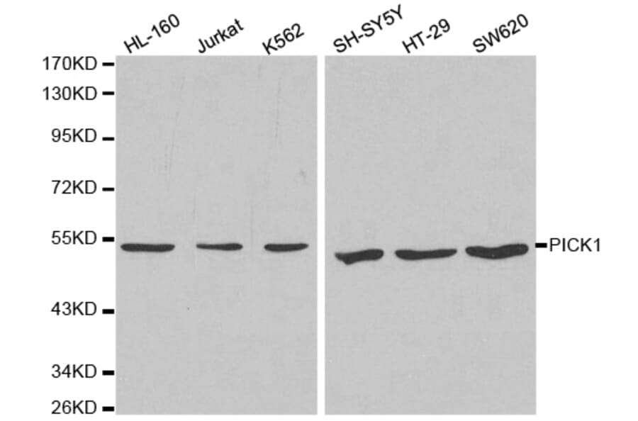 Western blot - PICK1 Antibody from Signalway Antibody (32296) - Antibodies.com