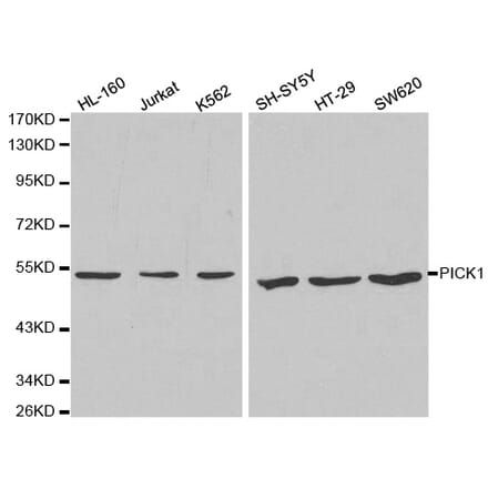 Western blot - PICK1 Antibody from Signalway Antibody (32296) - Antibodies.com